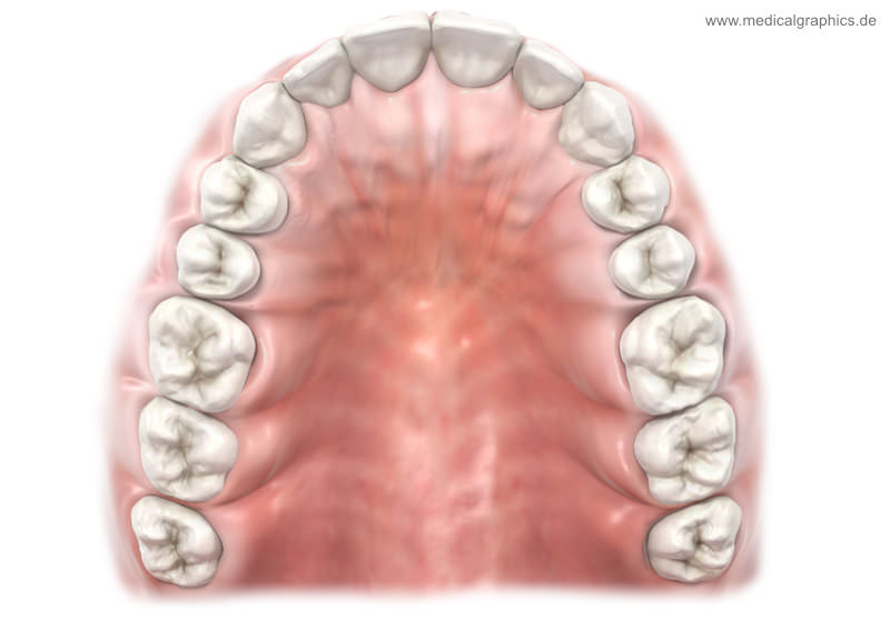 upper jaw teeth 20180129 1626818530